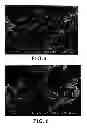 Fig. 03 - Filter casting nanoscale porous materials