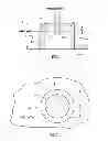 Fig. 02 - Pre-stressed gamma densitometer window and method of fabrication
