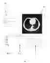 Fig. 09 - Methods and systems for analyzing, prioritizing, visualizing, and reporting medical images