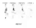 Fig. 14 - Efficient synthesis of chelators for nuclear imaging and radiotherapy: compositions and applications