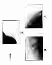 Fig. 02 - Generating a mucin-producing cell from an umbilical cord amniotic membrane epithelial stem cell