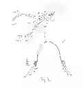 Fig. 02 - Orthodontic torquing