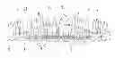 Fig. 01 - Orthodontic system