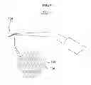 Fig. 08 - Ultrasonic tip for an apicoectomy, and method for manufacturing same
