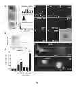 Fig. 02 - Increase of myeloid microvesicles in the cerebrospinal fluid as biomarker of microglia/macrophage activation in neurological disorders