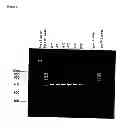 Fig. 07 - Detection kit containing a novel recombinant 15-kDA polypeptide useful for detecting human infection with 