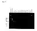 Fig. 09 - Detection kit containing a novel recombinant 15-kDA polypeptide useful for detecting human infection with 
