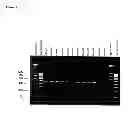 Fig. 10 - Detection kit containing a novel recombinant 15-kDA polypeptide useful for detecting human infection with 