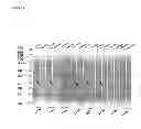 Fig. 12 - Detection kit containing a novel recombinant 15-kDA polypeptide useful for detecting human infection with 