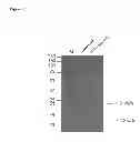 Fig. 15 - Detection kit containing a novel recombinant 15-kDA polypeptide useful for detecting human infection with 
