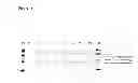 Fig. 17 - Detection kit containing a novel recombinant 15-kDA polypeptide useful for detecting human infection with 