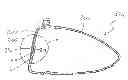 Fig. 01 - Golf club head with multi-material face