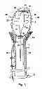 Fig. 04 - Fluid pump having a radially compressible rotor