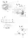 Fig. 05 - Control of blood flow assist systems