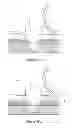Fig. 15 - Epidermal down-growth barrier