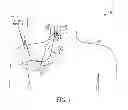 Fig. 02 - Method and apparatus for determination of physiological parameters using cervical impedance