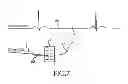 Fig. 06 - Methods, systems and devices for detecting atrial fibrillation