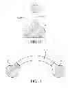 Fig. 08 - Methods, systems and devices for detecting atrial fibrillation
