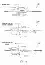 Fig. 06 - Systems and methods for use by implantable medical devices for detecting and discriminating stroke and cardiac ischemia using electrocardiac signals