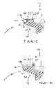 Fig. 07 - Stethoscope head with adjustable audio frequency