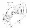 Fig. 01 - Mechanical pivot shift measurement to evaluate joints