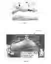 Fig. 03 - Mechanical pivot shift measurement to evaluate joints