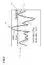 Fig. 02 - Lesion generation through bone using histotripsy therapy without aberration correction