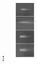 Fig. 09 - Lesion generation through bone using histotripsy therapy without aberration correction