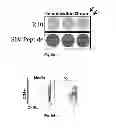 Fig. 07 - Oral mucosal electroporation device and use thereof