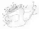 Fig. 01 - NASAL RINSING DEVICE