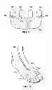 Fig. 08 - Foot manifolds, apparatuses, systems, and methods for applying reduced pressure to a tissue site on a foot