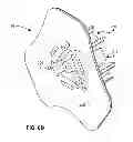 Fig. 12 - Sternal locators and associated systems and methods