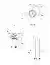 Fig. 17 - Sternal locators and associated systems and methods