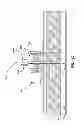 Fig. 22 - Sternal locators and associated systems and methods