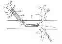 Fig. 01 - Multi wire sheath
