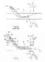 Fig. 04 - Multi wire sheath