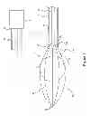 Fig. 02 - Cutting device and related methods of use