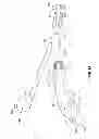 Fig. 02 - Surgical forceps