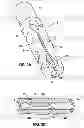 Fig. 03 - Surgical Snare with Electrosurgical Tip and Method of Use