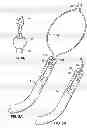 Fig. 06 - Surgical Snare with Electrosurgical Tip and Method of Use