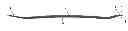 Fig. 01 - RADIUS INTRAMEDULLAR LOCKING NAIL