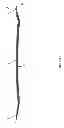 Fig. 02 - RADIUS INTRAMEDULLAR LOCKING NAIL
