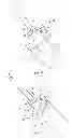 Fig. 04 - PROSTHESIS RESECTION GUIDE