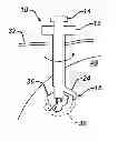 Fig. 01 - Methods and devices for preparing and implanting tissue scaffolds