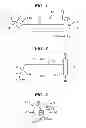 Fig. 02 - Methods and devices for preparing and implanting tissue scaffolds