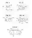 Fig. 06 - Methods and devices for preparing and implanting tissue scaffolds