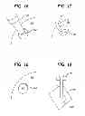 Fig. 07 - Methods and devices for preparing and implanting tissue scaffolds