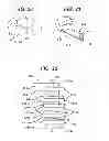 Fig. 08 - Methods and devices for preparing and implanting tissue scaffolds
