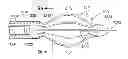 Fig. 01 - Apparatus and methods for internal surgical procedures