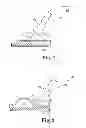 Fig. 02 - Apparatus and methods for internal surgical procedures